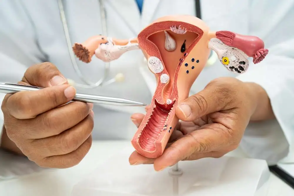 What Is Uterine Fibroid Embolization